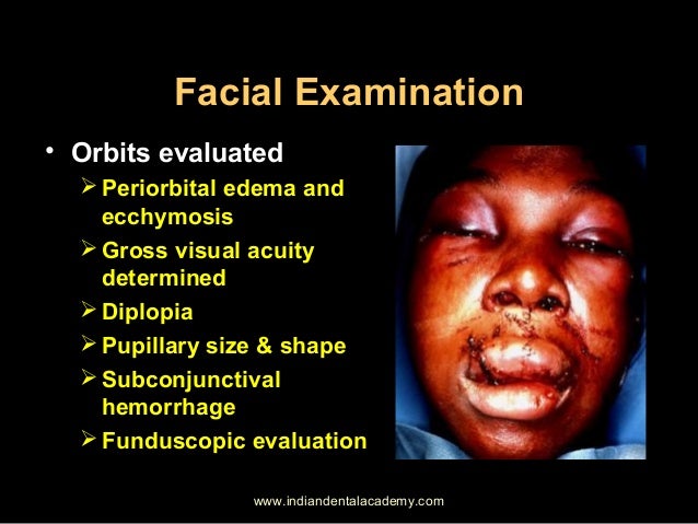 evaluate facial trauma Evaluate facial trauma